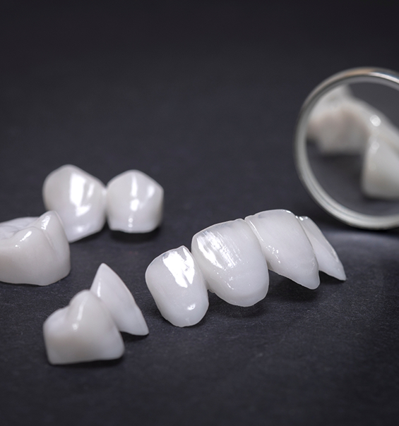 Several dental veneers on a table