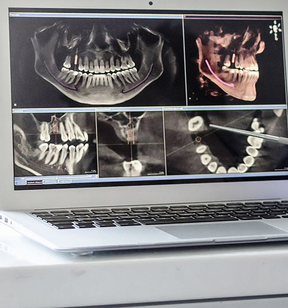 Screen showing several images of a skull and teeth from different angles