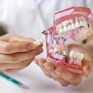 Dentist holding a dental bridge and a model of the mouth with two dental implants