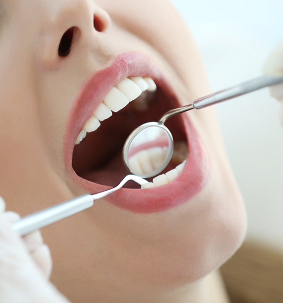 Person opening their mouth for a dental checkup in West Palm Beach