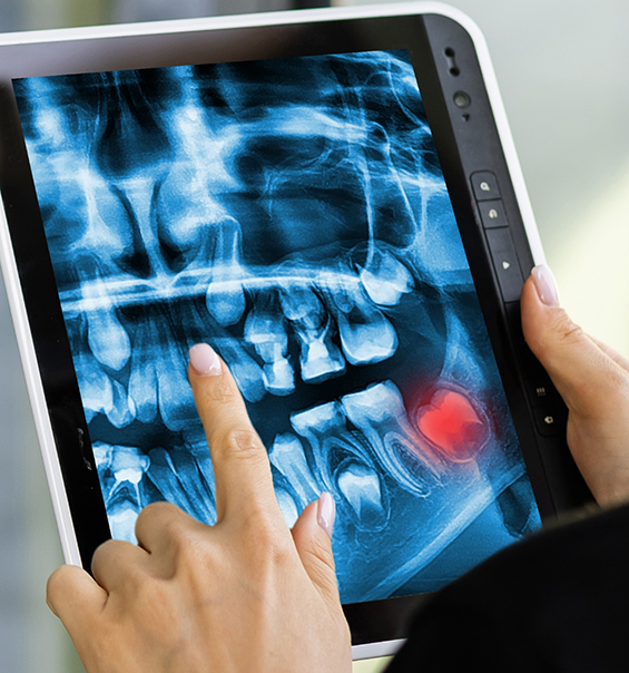 Dentist looking at a screen with x ray of teeth