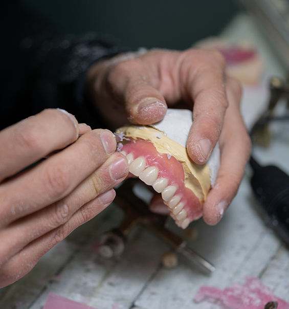 Dental ceramist designing a denture