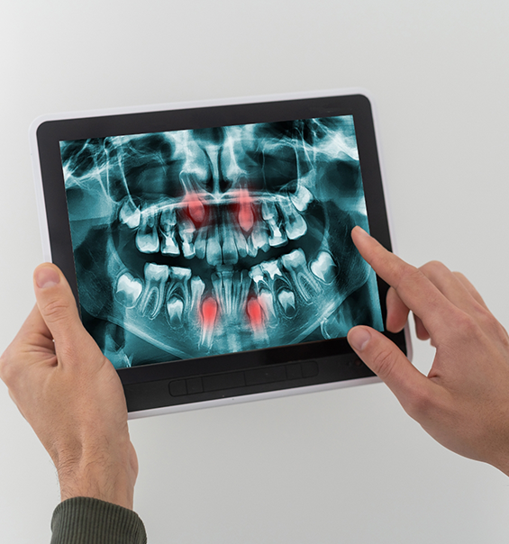 Person holding a tablet showing digital dental x ray of teeth