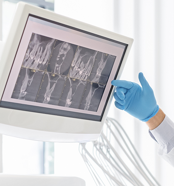 Dentist gesturing to a screen showing several x rays of teeth