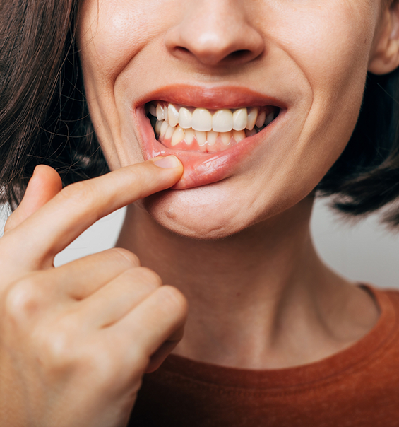 Person pointing to red spot in their gums before gum disease treatment