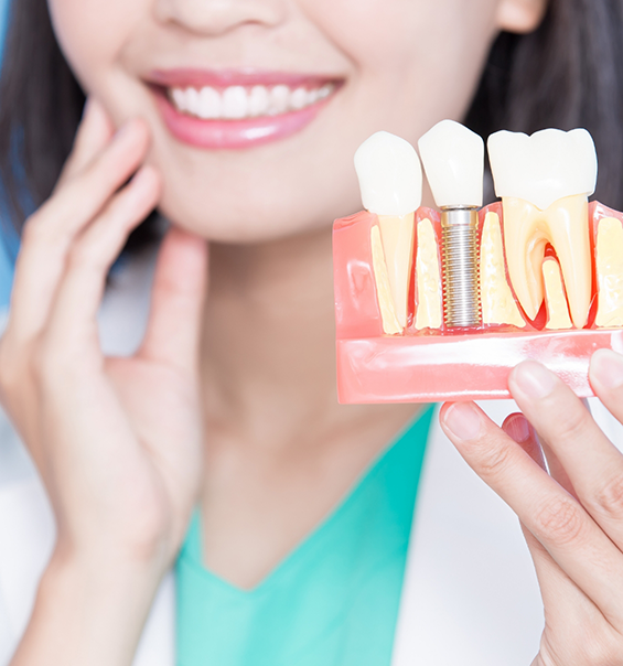 Smiling dentist holding a model of a dental implant