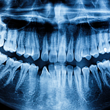 Cone Beam Dental Scan