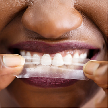 Close up of person placing a whitening strip over their teeth