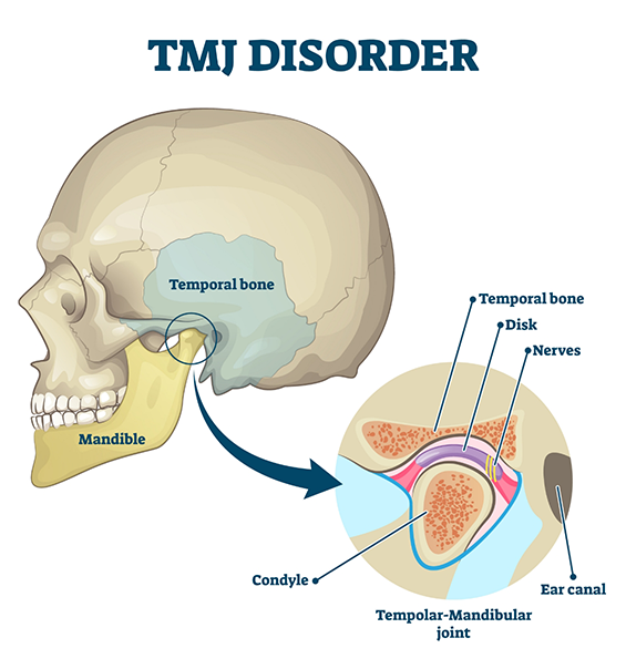 Diagram of the skull showing the T M J